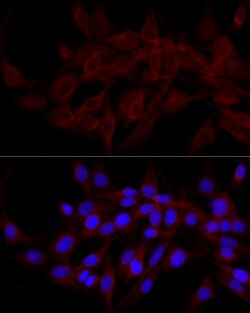 Invitrogen CALCOCO2 Polyclonal Antibody 100 &mu;L | Buy Online | Invitrogen&trade; | Fisher Scientific
