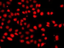 Invitrogen HIF-2 alpha Polyclonal Antibody 100 &mu;L; Unconjugated:Antibodies,