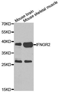 Invitrogen IFNGR2 Polyclonal Antibody 100 &mu;L; Unconjugated:Antibodies,