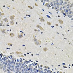 Invitrogen CD49b (Integrin alpha 2) Polyclonal Antibody 100 &mu;L; Unconjugated:Antibodies,
