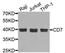 Invitrogen CD7 Polyclonal Antibody 100 &mu;L; Unconjugated:Antibodies,