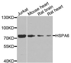 Invitrogen HSPA6 Polyclonal Antibody 100 &mu;L; Unconjugated:Antibodies,