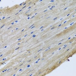 Invitrogen YBX1 Polyclonal Antibody 100 &mu;L; Unconjugated:Antibodies,