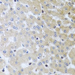 Invitrogen YBX1 Polyclonal Antibody 100 &mu;L; Unconjugated:Antibodies,