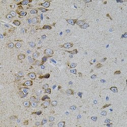 Invitrogen p38 MAPK beta Polyclonal Antibody 100 &mu;L; Unconjugated:Antibodies,