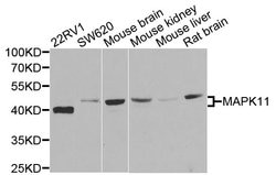 Invitrogen p38 MAPK beta Polyclonal Antibody 100 &mu;L; Unconjugated:Antibodies,