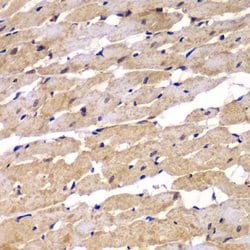 Invitrogen PSEN2 Polyclonal Antibody 100 &mu;L; Unconjugated:Antibodies,