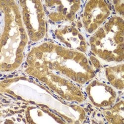 Invitrogen PSEN2 Polyclonal Antibody 100 &mu;L; Unconjugated:Antibodies,