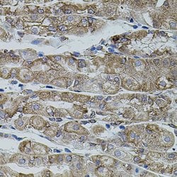 Invitrogen SHH Polyclonal Antibody 100 &mu;L; Unconjugated:Antibodies,