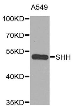 Invitrogen SHH Polyclonal Antibody 100 &mu;L; Unconjugated:Antibodies,