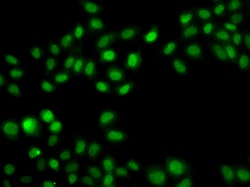 Invitrogen SULT2B1 Polyclonal Antibody 100 &mu;L; Unconjugated:Antibodies,