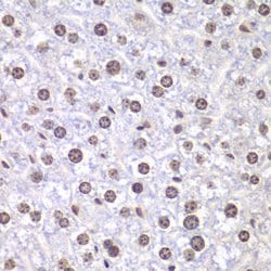 Invitrogen TOP1 Polyclonal Antibody 100 &mu;L | Buy Online | Invitrogen&trade; | Fisher Scientific