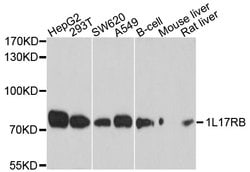 Invitrogen IL17RB Polyclonal Antibody 100 &mu;L; Unconjugated:Antibodies,