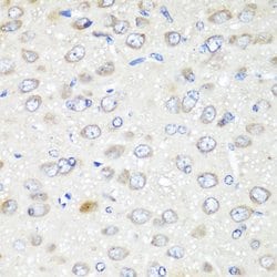 Invitrogen GABARAPL2 Polyclonal Antibody 100 &mu;L; Unconjugated:Antibodies,