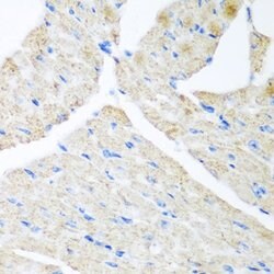 Invitrogen GABARAPL2 Polyclonal Antibody 100 &mu;L; Unconjugated:Antibodies,