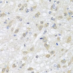Invitrogen HARS2 Polyclonal Antibody 100 &mu;L; Unconjugated:Antibodies,