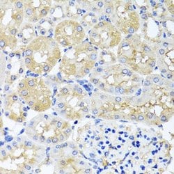 Invitrogen HARS2 Polyclonal Antibody 100 &mu;L; Unconjugated:Antibodies,