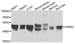 Invitrogen HARS2 Polyclonal Antibody 100 &mu;L; Unconjugated:Antibodies,