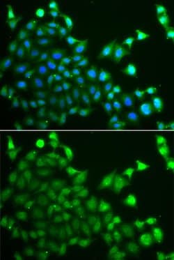 Invitrogen CBLC Polyclonal Antibody 100 &mu;L | Buy Online | Invitrogen&trade; | Fisher Scientific
