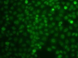 Invitrogen CBLC Polyclonal Antibody 100 &mu;L | Buy Online | Invitrogen&trade; | Fisher Scientific