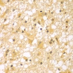 Invitrogen PAK6 Polyclonal Antibody 100 &mu;L; Unconjugated:Antibodies,