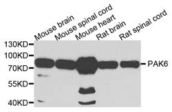 Invitrogen PAK6 Polyclonal Antibody 100 &mu;L; Unconjugated:Antibodies,