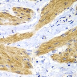 Invitrogen H-Ras Polyclonal Antibody 100 &mu;L | Buy Online | Invitrogen&trade; | Fisher Scientific