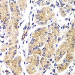 Invitrogen H-Ras Polyclonal Antibody 100 &mu;L | Buy Online | Invitrogen&trade; | Fisher Scientific