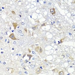 Invitrogen PSPH Polyclonal Antibody 100 &mu;L; Unconjugated:Antibodies,