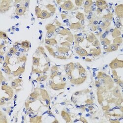 Invitrogen PSPH Polyclonal Antibody 100 &mu;L; Unconjugated:Antibodies,