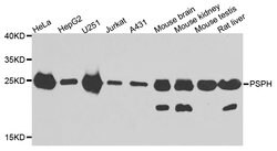 Invitrogen PSPH Polyclonal Antibody 100 &mu;L; Unconjugated:Antibodies,