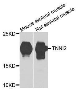 Invitrogen TNNI2 Polyclonal Antibody 100 &mu;L; Unconjugated:Antibodies,