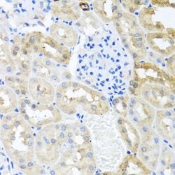 Invitrogen MYLK Polyclonal Antibody 100 &mu;L; Unconjugated:Antibodies,