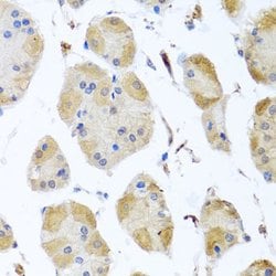 Invitrogen MYLK Polyclonal Antibody 100 &mu;L; Unconjugated:Antibodies,