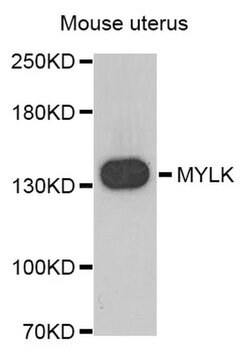 Invitrogen MYLK Polyclonal Antibody 100 &mu;L; Unconjugated:Antibodies,