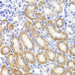 Invitrogen HMGCL Polyclonal Antibody 100 &mu;L; Unconjugated:Antibodies,