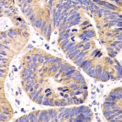 Invitrogen HMGCL Polyclonal Antibody 100 &mu;L; Unconjugated:Antibodies,