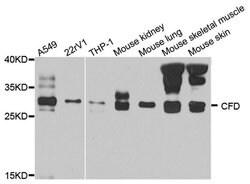 Invitrogen Complement Factor D Polyclonal Antibody 100 &mu;L; Unconjugated:Antibodies,