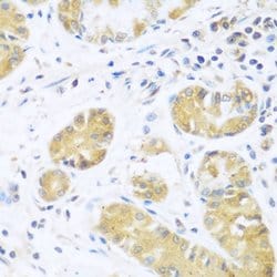 Invitrogen UCHL3 Polyclonal Antibody 100 &mu;L; Unconjugated:Antibodies,