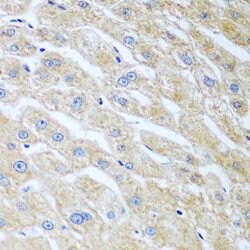 Invitrogen UCHL3 Polyclonal Antibody 100 &mu;L; Unconjugated:Antibodies,