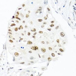 Invitrogen Nuclear Matrix Protein p84 Polyclonal Antibody 100 &mu;L; Unconjugated:Antibodies,
