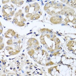 Invitrogen IL-29 Polyclonal Antibody 100 &mu;L; Unconjugated:Antibodies,