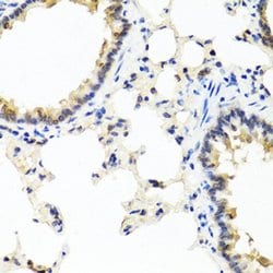 Invitrogen IL-29 Polyclonal Antibody 100 &mu;L; Unconjugated:Antibodies,