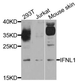 Invitrogen IL-29 Polyclonal Antibody 100 &mu;L; Unconjugated:Antibodies,