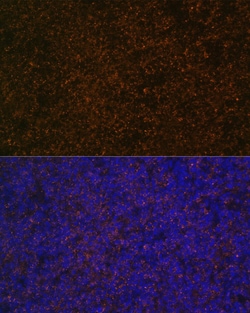 Invitrogen CD21 Polyclonal Antibody 100 &mu;L; Unconjugated:Antibodies,