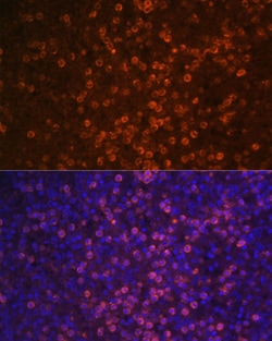 Invitrogen CD21 Polyclonal Antibody 100 &mu;L; Unconjugated:Antibodies,