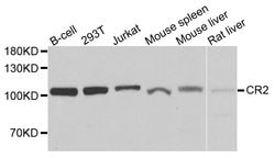 Invitrogen CD21 Polyclonal Antibody 100 &mu;L; Unconjugated:Antibodies,