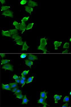 Invitrogen Glutamine Synthetase Polyclonal Antibody 100 &mu;L; Unconjugated:Antibodies,