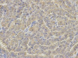 Invitrogen Glutamine Synthetase Polyclonal Antibody 100 &mu;L; Unconjugated:Antibodies,