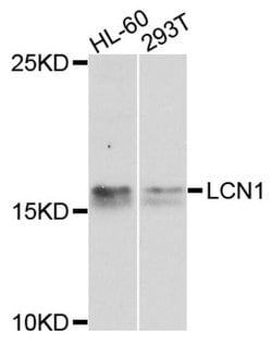 Invitrogen LCN1 Polyclonal Antibody 100 &mu;L; Unconjugated:Antibodies,